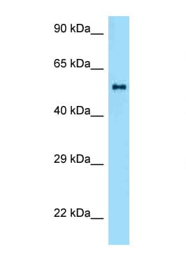 ZBTB37 Antibody (aa251-300)