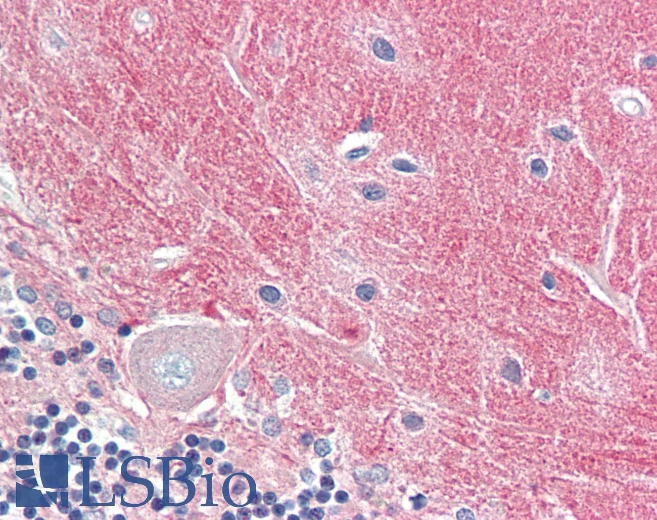PathPlus™ Polyclonal Goat anti-Human CNTN1 / gp135 / Contactin 1 Antibody (aa858-870, IHC, WB)