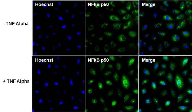 Monoclonal Mouse anti-Human NFKB1 / NF-Kappa-B Antibody (clone 5D10D11, IHC, IF, WB)