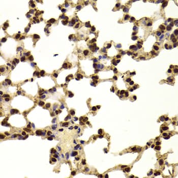 AAAS / Adracalin Antibody