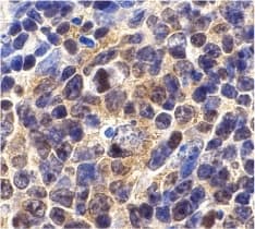 BIRC5 / Survivin Antibody