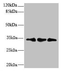 IHC-plus™ RCD1 / RQCD1 Antibody