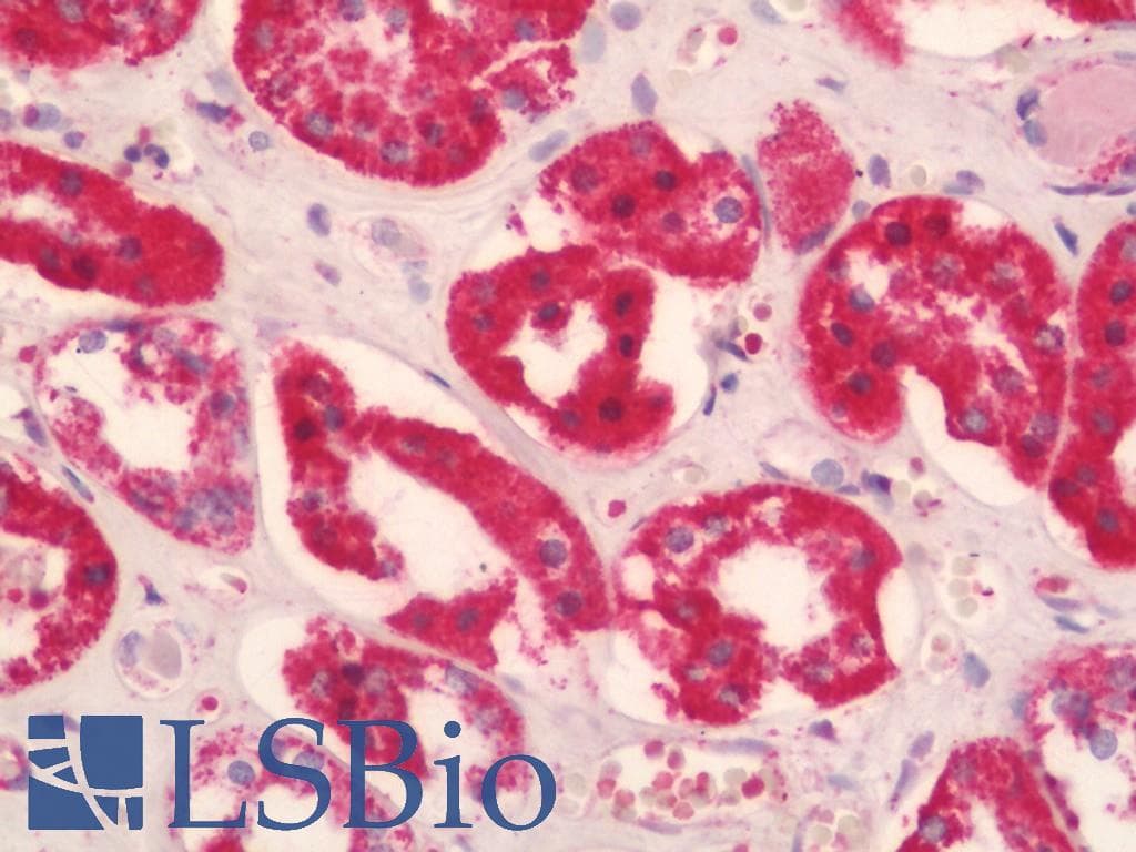 IHC-plus™ PS20 / WFDC1 Antibody (aa148-177)