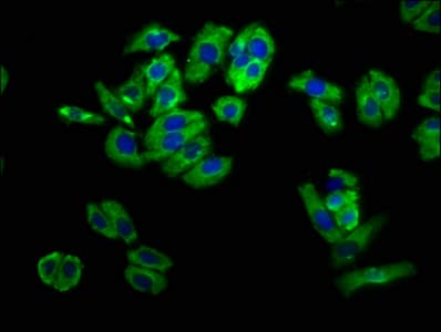 UNC5H2 / UNC5B Antibody