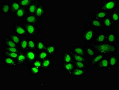 NAMPT / Visfatin Antibody