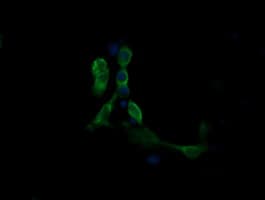 MAP2K1 / MKK1 / MEK1 Antibody (clone OTI2G5, Carrier-free)