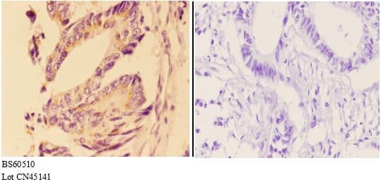 Polyclonal Rabbit anti-Human Angiogenin / ANG Antibody (IHC, WB)