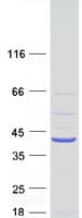 Human C2orf27B Protein (Recombinant Myc-DDK (Flag))