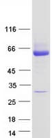 Human UGT2B15 Protein (Recombinant Myc-DDK (Flag))