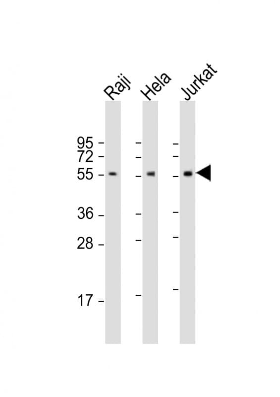 Polyclonal Rabbit anti-Human IRF3 Antibody (aa78-108, WB)