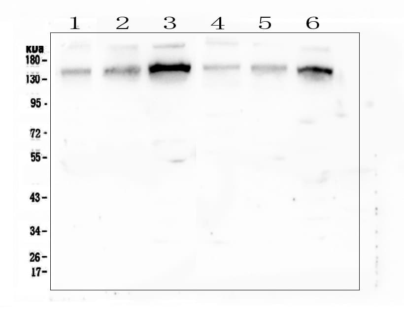 Polyclonal Rabbit anti-Human GOLGA2 / GM130 Antibody (IHC, WB)