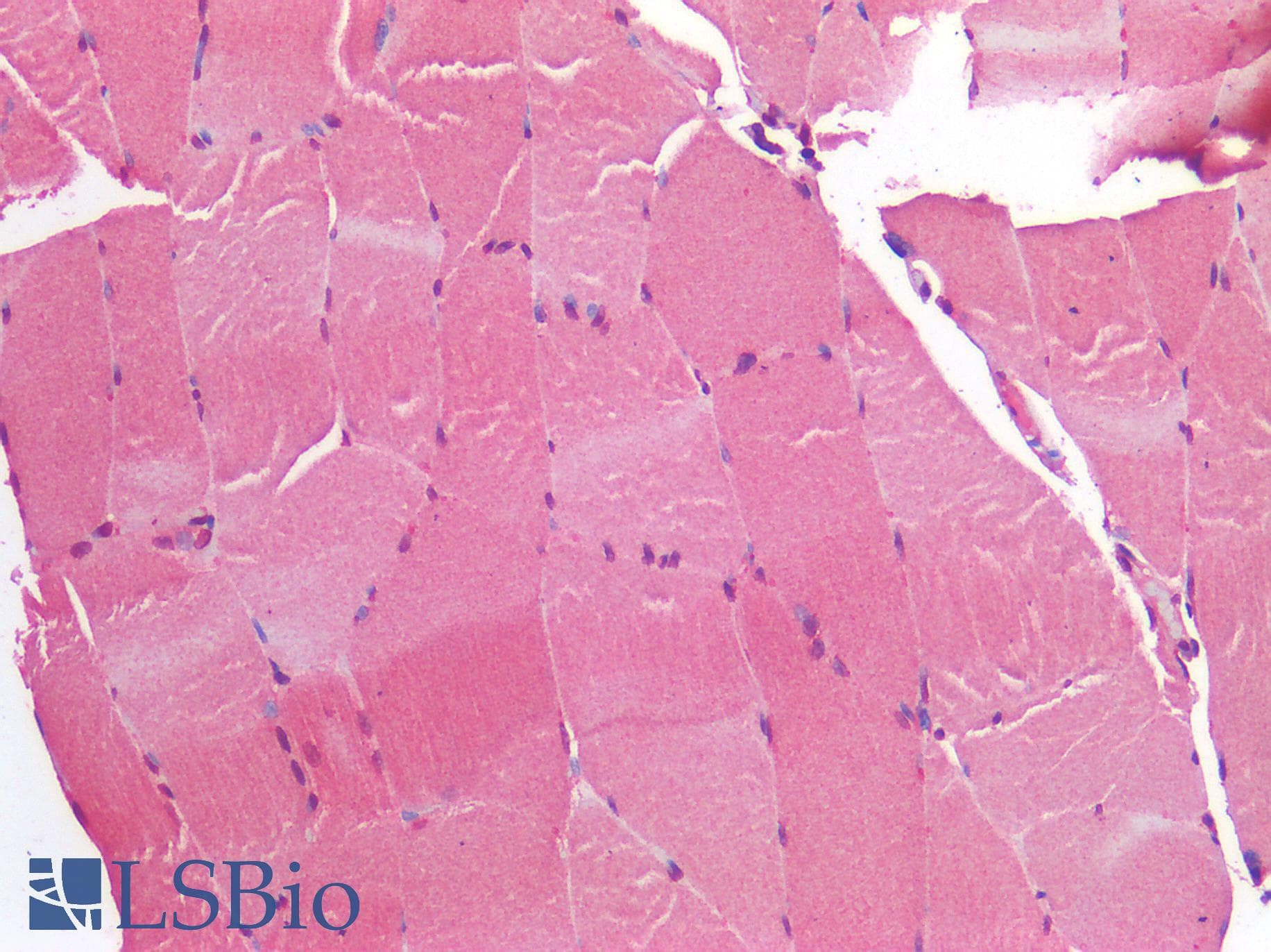IHC-plus™ IGF1R / IGF1 Receptor Antibody