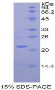 Human GAA / Alpha-Glucosidase, Acid Protein (Recombinant His)