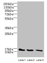 Polyclonal Rabbit anti-Human C2orf15 Antibody (IHC, WB)
