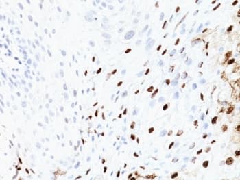Monoclonal Mouse anti-Human Papillomavirus 16 Human Papilloma Virus 16 Antibody (clone SPM405, IHC, IF)