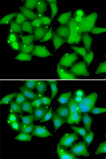 UBASH3B / STS-1 Antibody