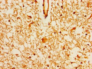 MAGI2 / AIP-1 Antibody