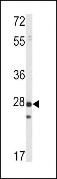 PTP4A1 / PRL-1 Antibody