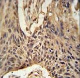 LPPR4 / PRG1 Antibody (aa666-695)
