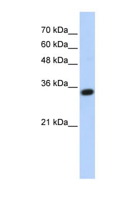 C1QTNF4 / CTRP4 Antibody (aa107-156)
