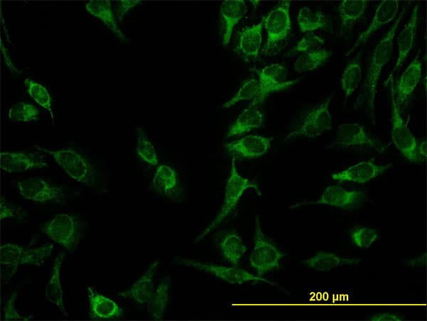 GT335 / ES1 Antibody (clone 1F5)