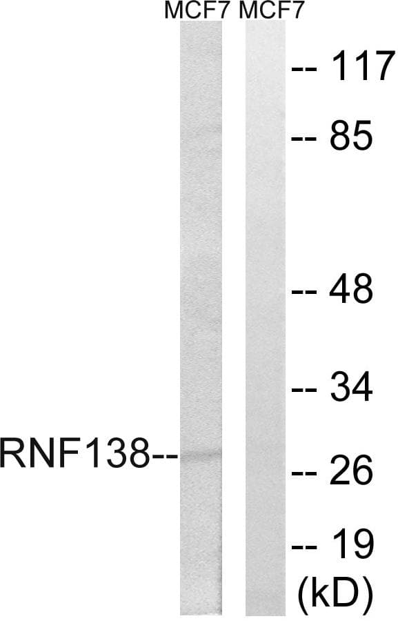 RNF138 Antibody