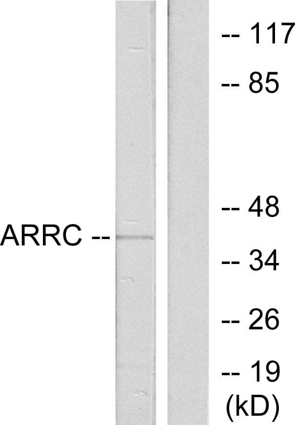 ARR3 / Cone Arrestin Antibody