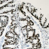 Polyclonal Rabbit anti-Human BAF53 / ACTL6A Antibody (Internal, IHC, IF, WB)