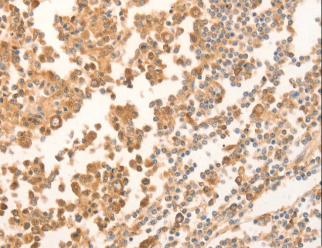 NAP1L1 Antibody