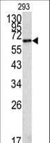 METAP2 Antibody (aa437-467)
