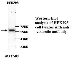 Vimentin Antibody (Internal)