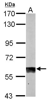 SUOX / Sulfite Oxidase Antibody (aa1-291)
