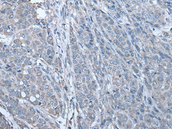 PARP13 / ZC3HAV1 Antibody