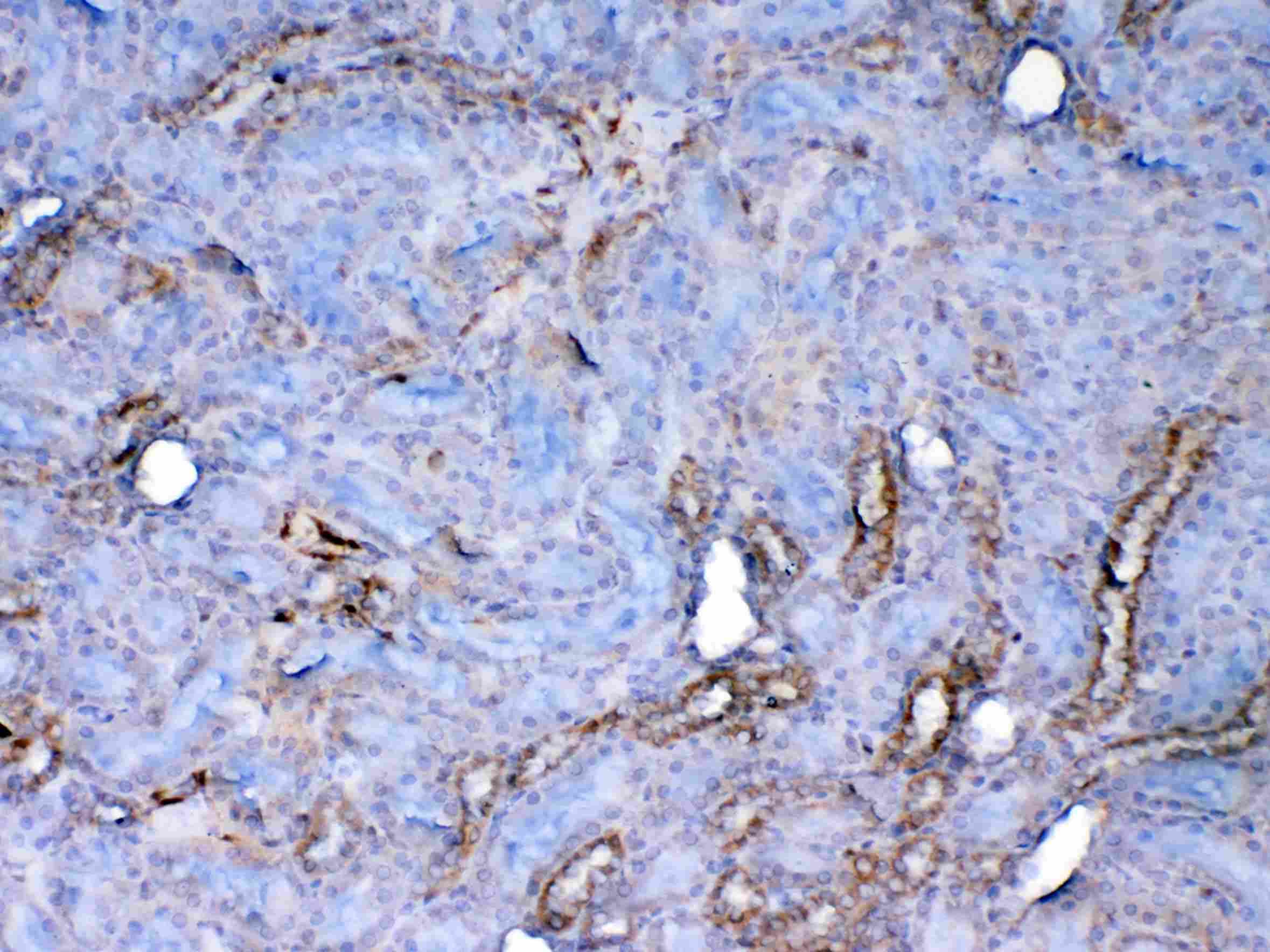LGALS1 / Galectin 1 Antibody