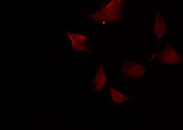 ABL1 / c-ABL Antibody (phospho-Tyr393,pTyr412)