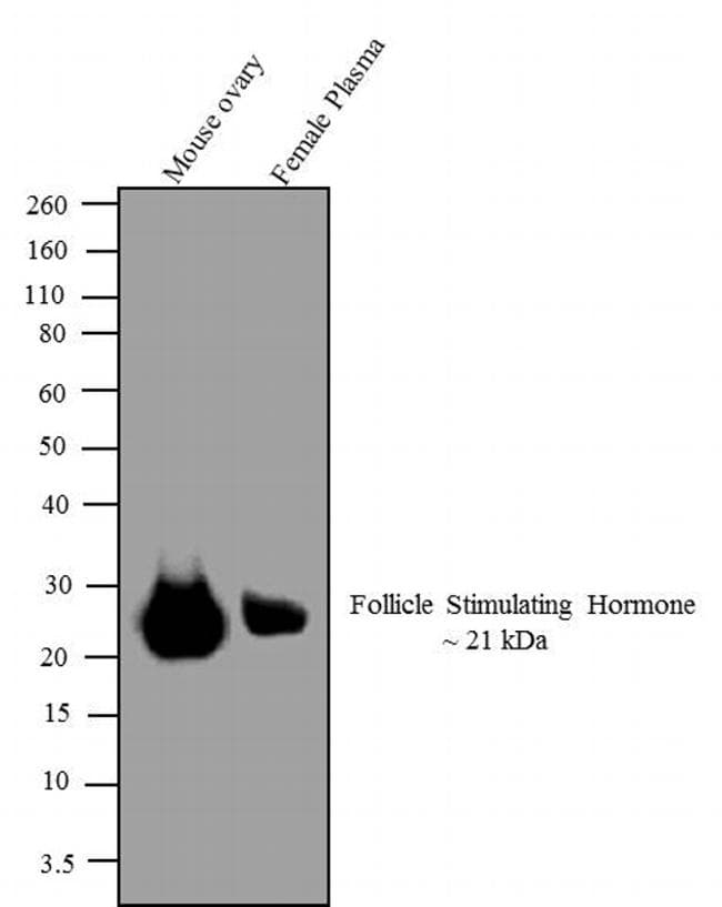 FSH Antibody (clone P2H3)
