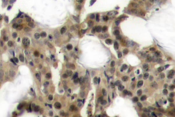 Polyclonal Rabbit anti-Human EIF4EBP1 / 4EBP1 Antibody (Gly39, IHC, WB)