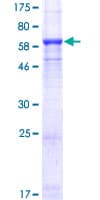 Human SMYD3 Protein (Recombinant GST)