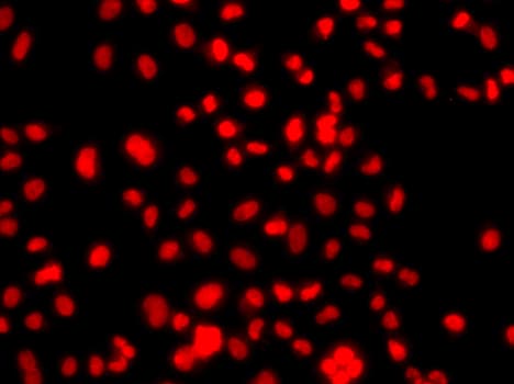 PRICKLE2 Antibody