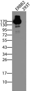 ERBB2 / HER2 Antibody (aa676-1255, clone UMAB35, Carrier-free)
