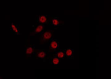 Polyclonal Rabbit anti-Human CBX6 Antibody (IF, WB)