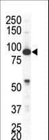 Polyclonal Rabbit anti-Human EPHA4 / EPH Receptor A4 Antibody (aa875-904, IHC, WB)