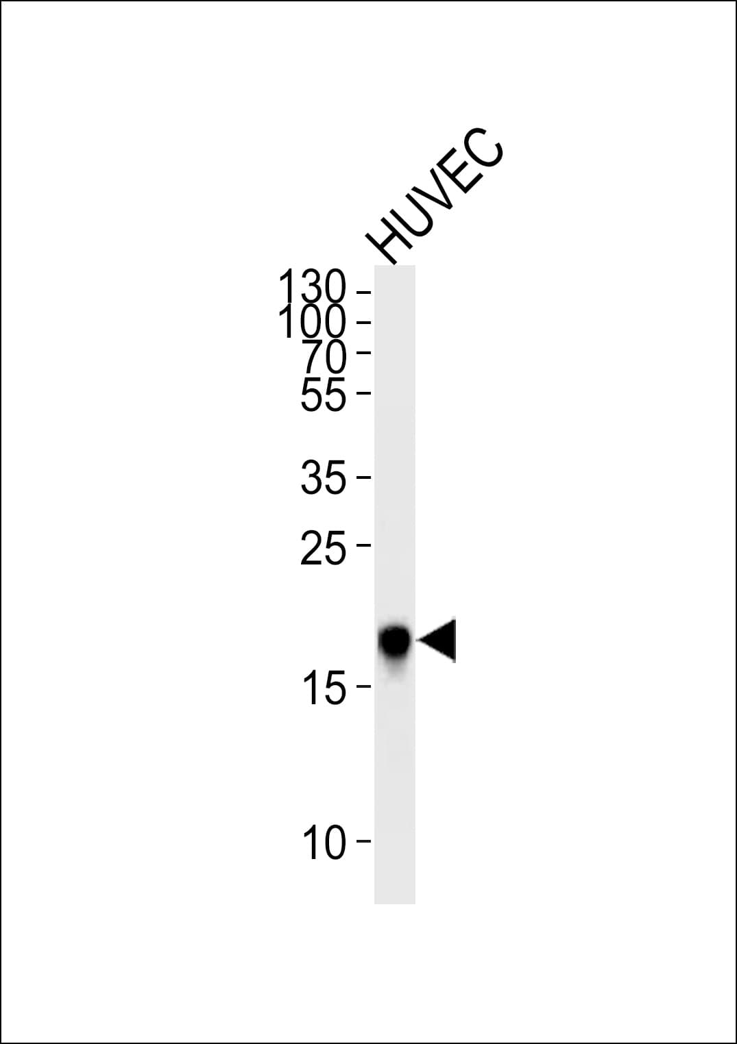Polyclonal Rabbit anti-Human CAV2 / Caveolin 2 Antibody (aa11-44, IHC, IF, WB)