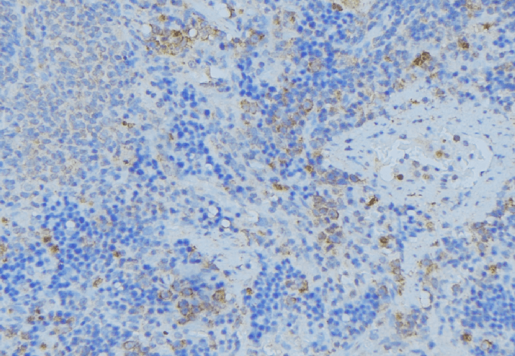 GSTA1 Antibody