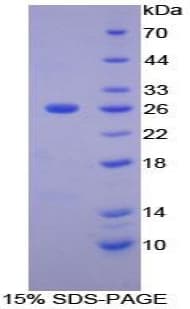 Human MMP11 Protein (Recombinant His)