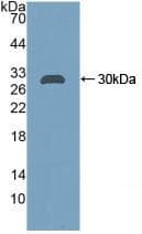 CA2 / Carbonic Anhydrase II Antibody (aa1-260, APC)