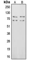 Polyclonal Rabbit anti-Human VTN / Vitronectin Antibody (Internal, WB)