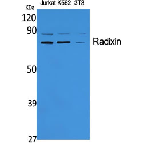 RDX / Radixin Antibody (120-200 aa, Internal)