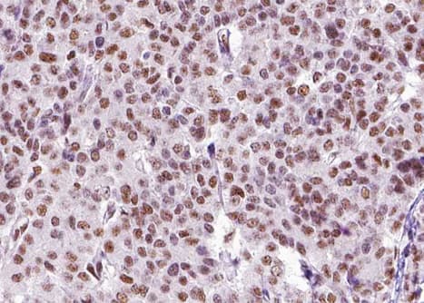 Polyclonal Rabbit anti-Human ZEB2 / SIP-1 Antibody (IHC, IF, WB)