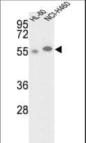 Polyclonal Rabbit anti-Human GALK2 Antibody (aa1-30, WB)